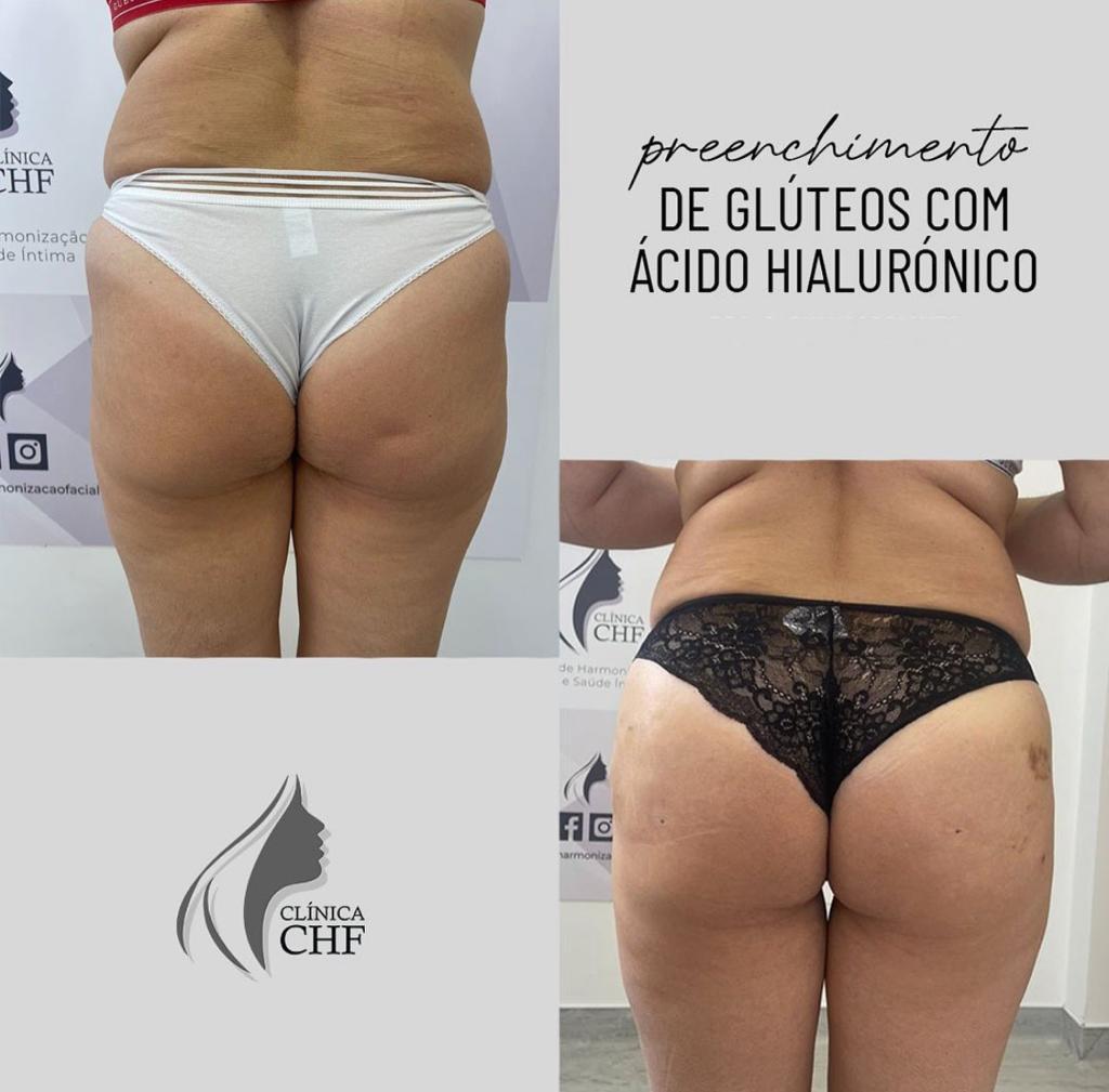 2eb809_08a9632670ad45848fa5e0f03da41801_mv2